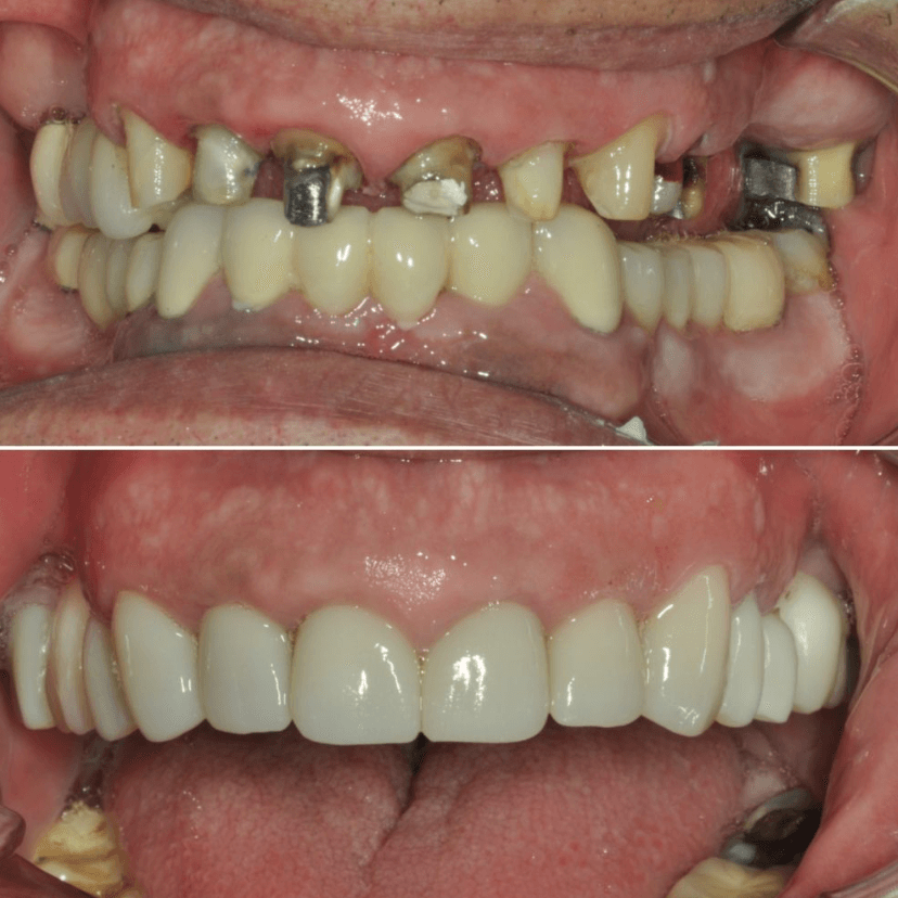Before & After Photo