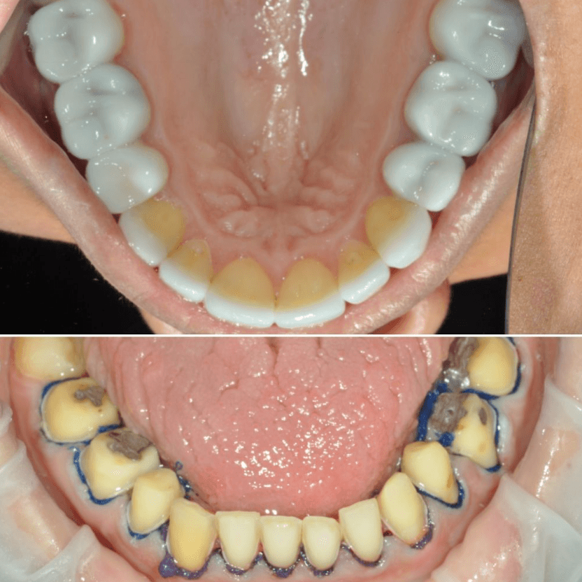 Before & After Photo